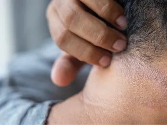 Stock photograph of a model: a hand holds back the hair on a man's neck, showing a patch of irritated skin