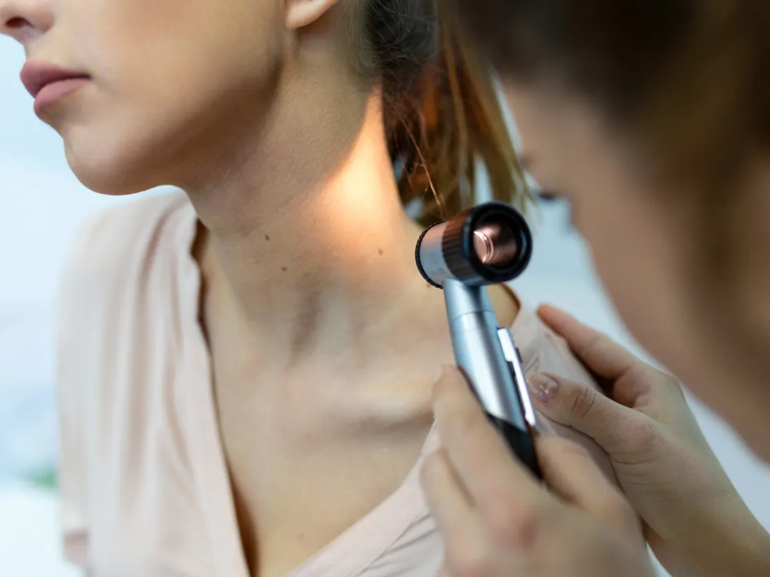 Stock photograph of models: a clinician examines a mole on a woman's shoulder with a dermatoscope