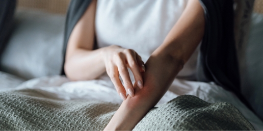 Stock photograph of a model: a woman sitting on a bed rubs a red, irritated patch on her forearm