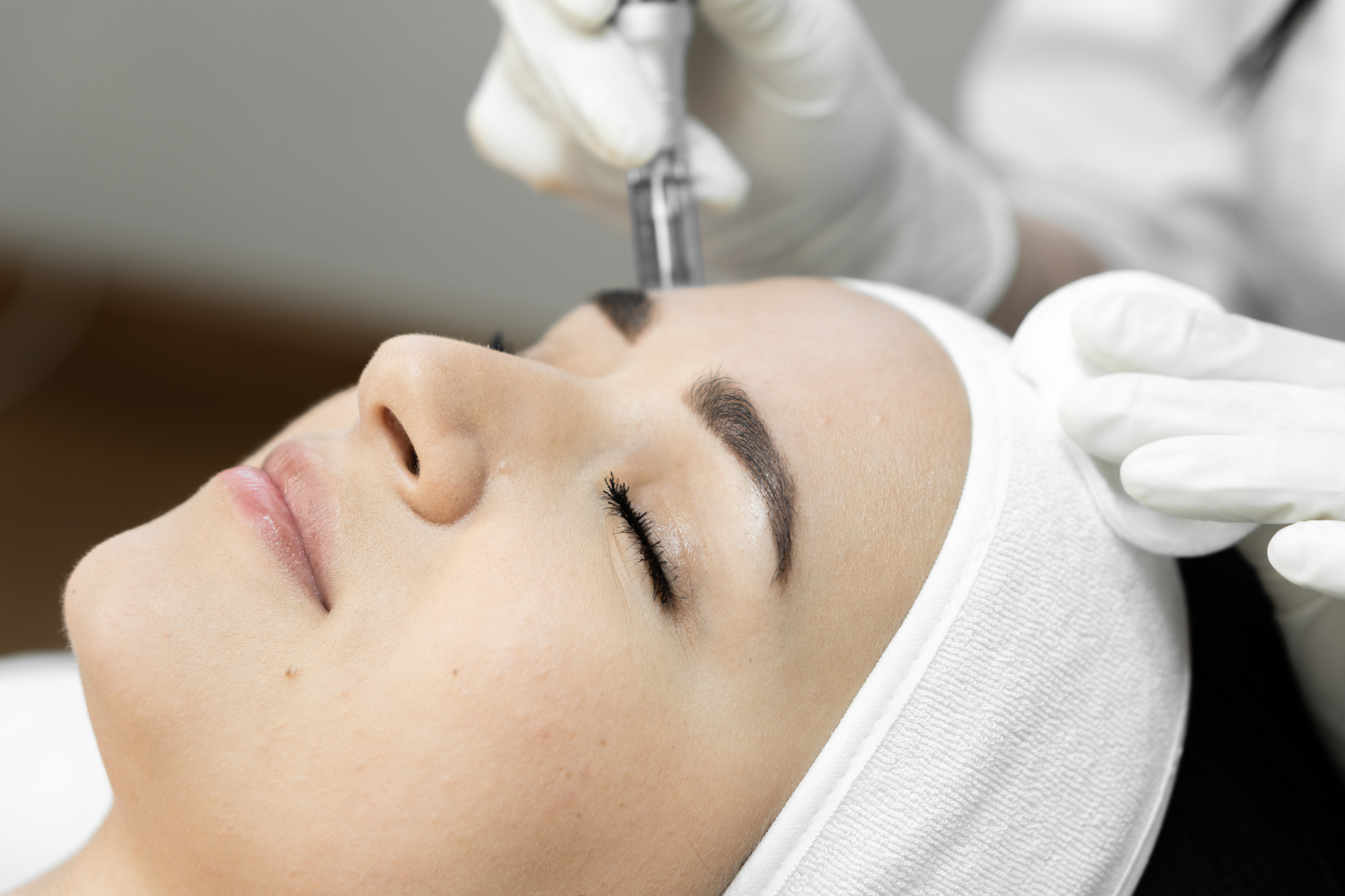 Stock photograph of models: a woman with a headband lies back with her eyes closed while a gloved clinician uses a microneedling pen on her face