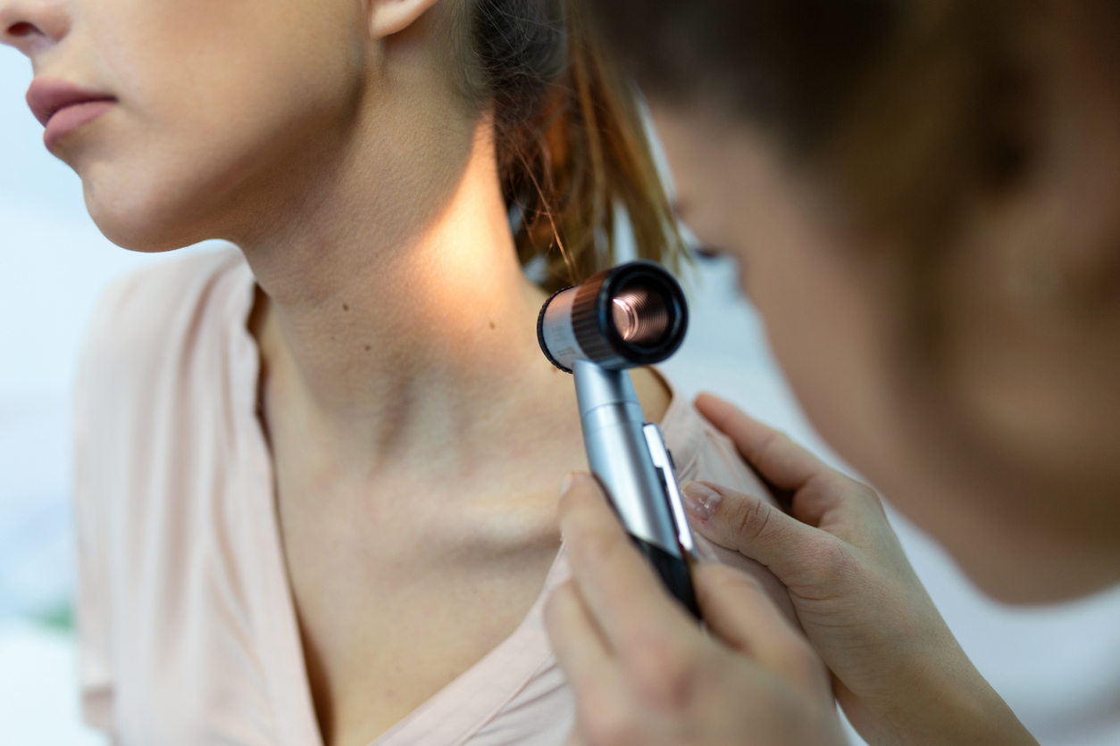 Stock photograph of models: a clinician examines a mole on a woman's shoulder with a dermatoscope