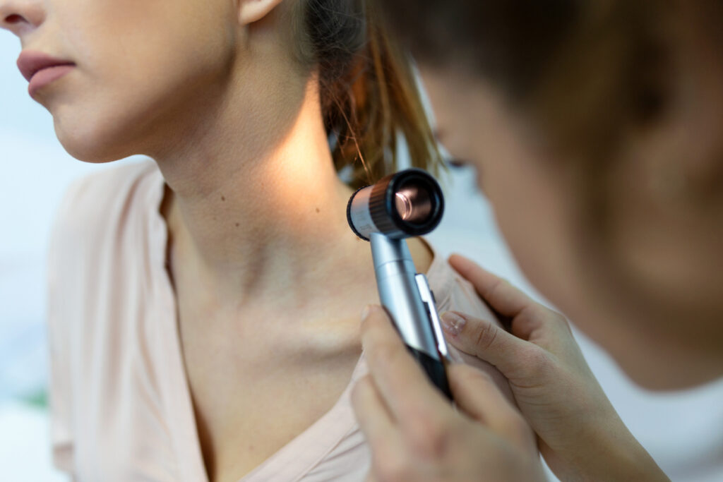 Dermatologist examining a mole for signs of melanoma.